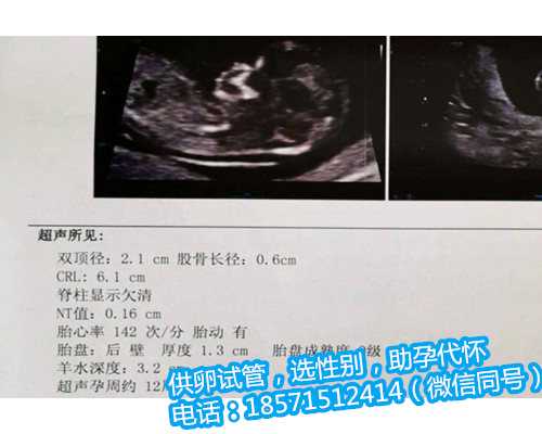 广州精子库地址，看完你就知道广州哪些医院有精子库了